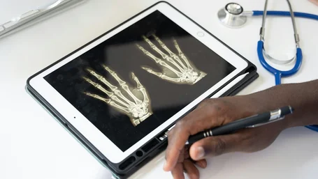 Tablet displaying a hand X-ray next to a stethoscope on a desk